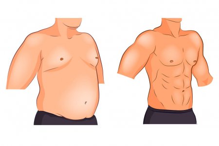 Enlarged Male Breast