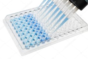 ELISA HIV TEST