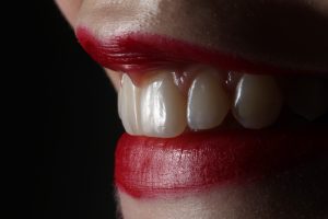 teeth Straightening Treatment