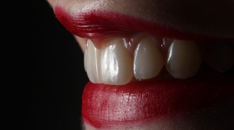 teeth Straightening Treatment