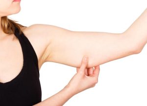 Arm Lift