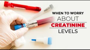 Ayurvedic medicine for Creatinine