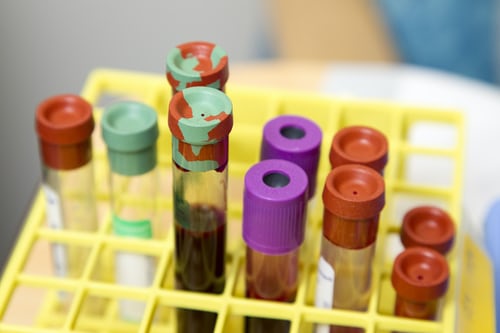 What are the different types of Pathology Tests?